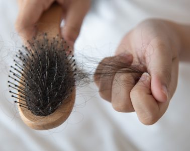 hair loss in older women